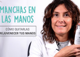 ¿Cómo quitar las manchas en las manos? ¿Por qué salen estas manchas?