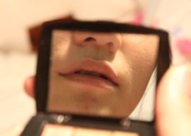 Tratamiento para el Código de Barras en los Labios