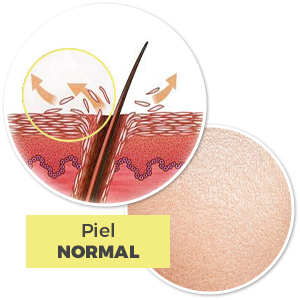 queratosis pilaris fotos